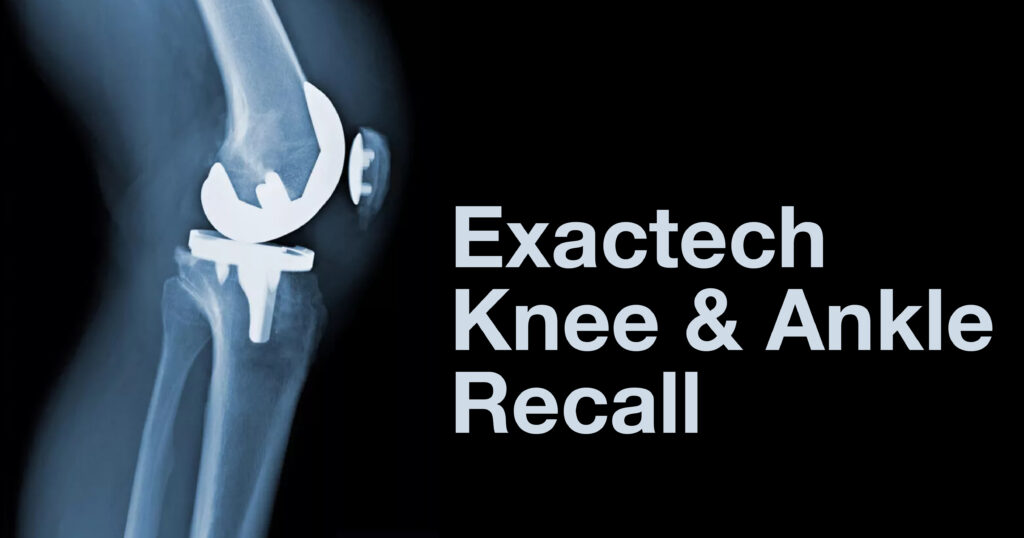How you can Submit a Court action for Knee Problems – One Step-by-Phase Guide post thumbnail image